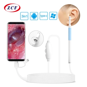 AN102 3in1 Kõrva Endoscope HD720P Visuaalne Kõrva korjaja 5,5 mm kõrva tunneli Kaamera USB-Visuaalne Kõrva Puhastaja otoscope medical Kõrva Korja
